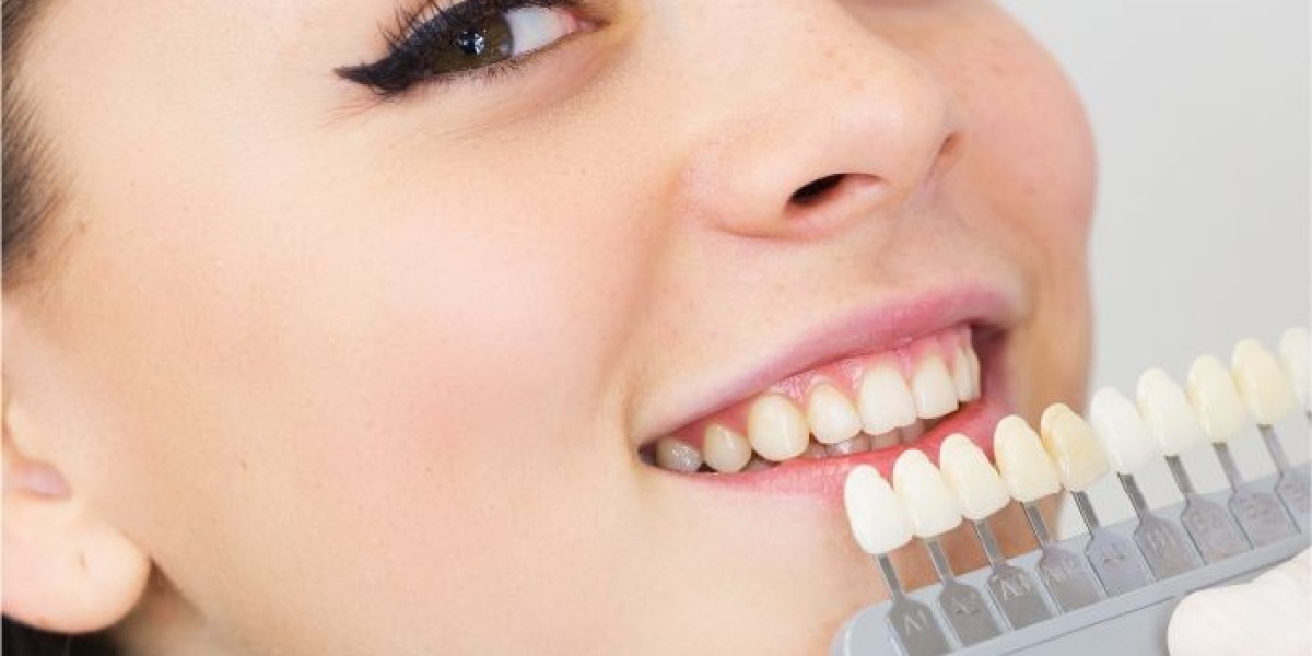 Quality Dental Services in Queens, New York: Your Path to a Radiant Smile