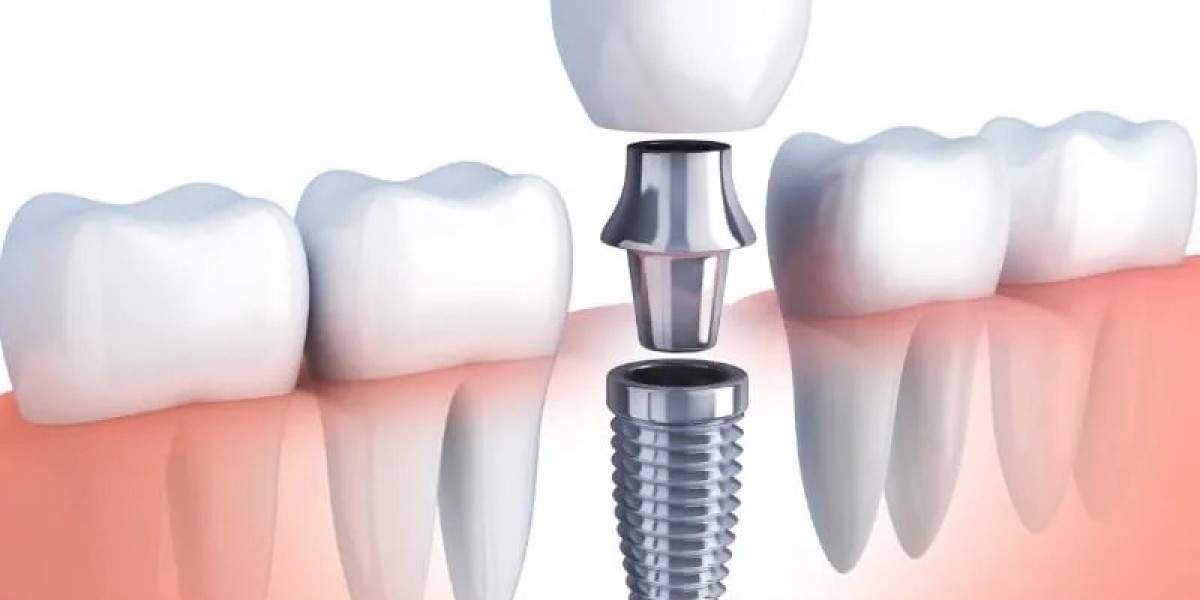 Affordable Dental Care Services in McKinney, TX: Comprehensive Guide to Accessible Dentistry