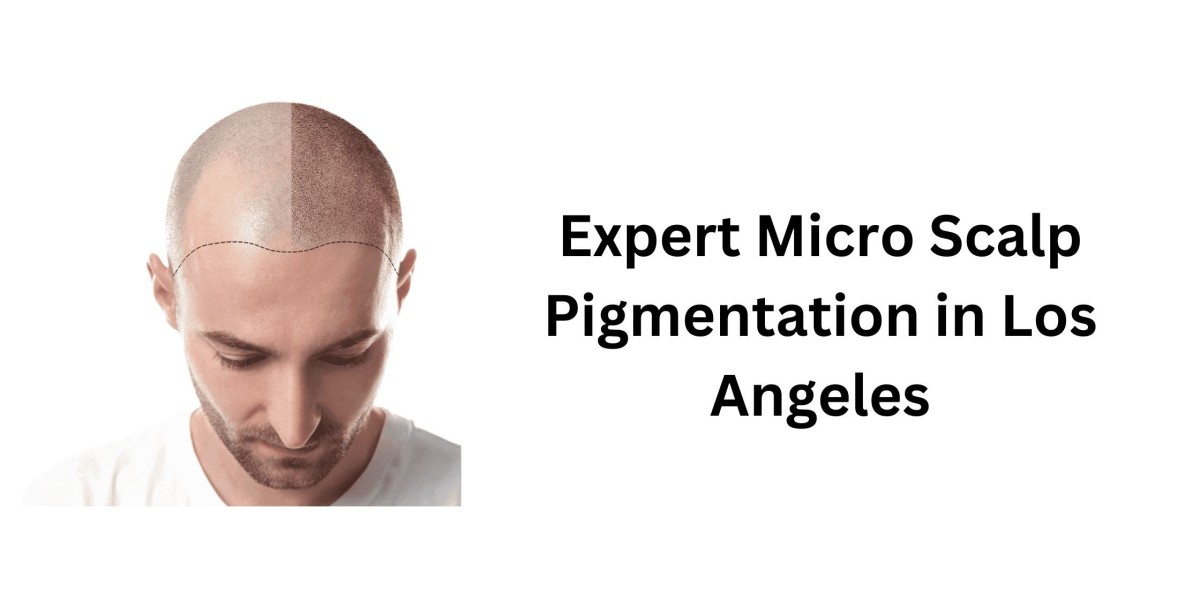 Expert Micro Scalp Pigmentation in Los Angeles