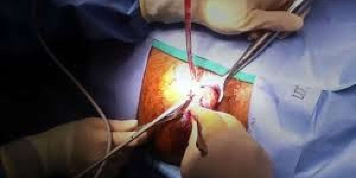 Best Piles Surgeon in Guwahati: Choose the Advanced Techniques with a Trusted Expert Care Surgeon
