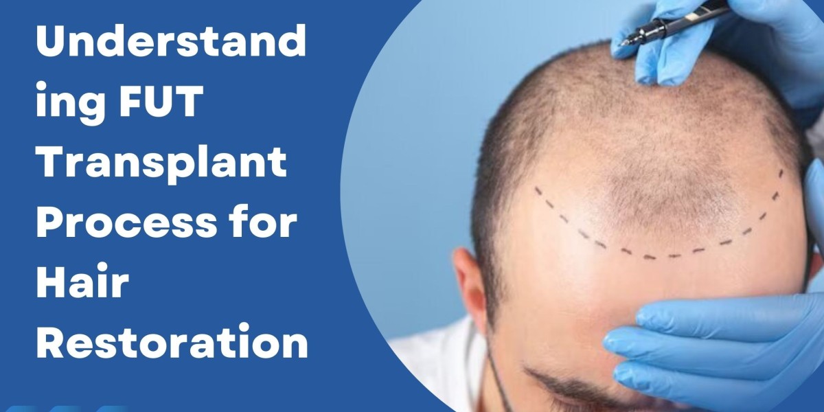 Understanding FUT Transplant Process for Hair Restoration