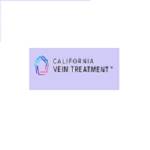 Vein Treatment California