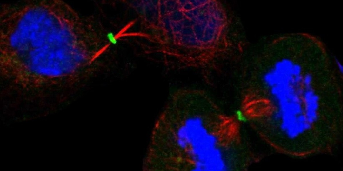 Utilizing Innovative Techniques to Uncover the Impact of Ribosomal Abnormalities