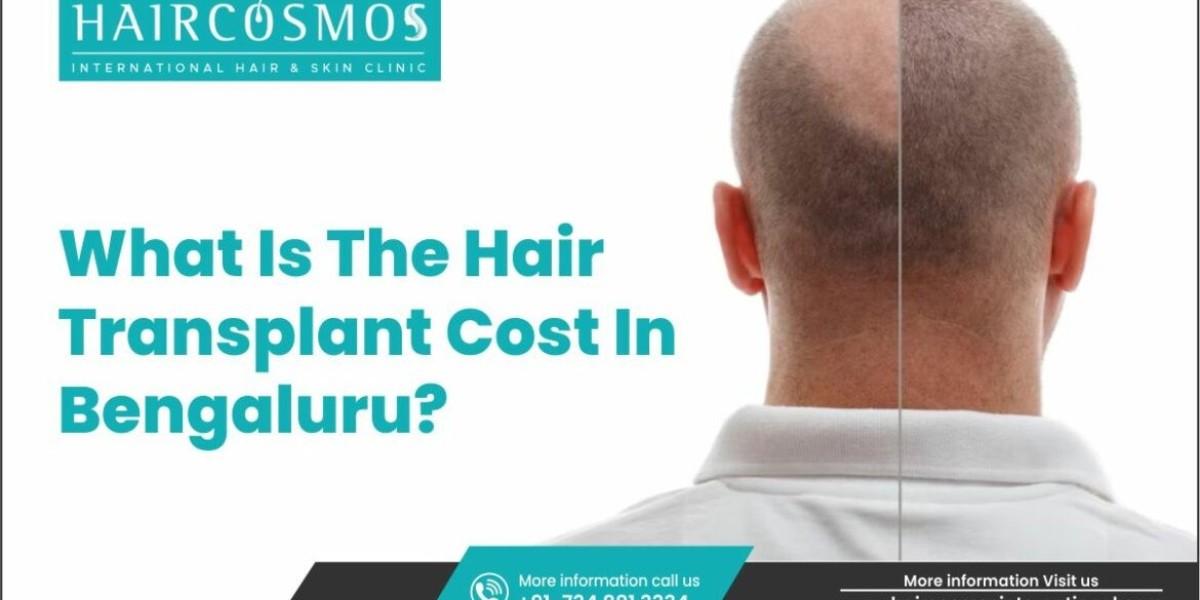 Affordable Hair Transplant Cost in Bangalore