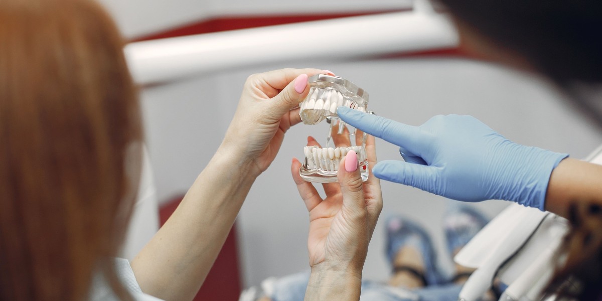 The Advantages of Dental Implants for Permanent Smiles