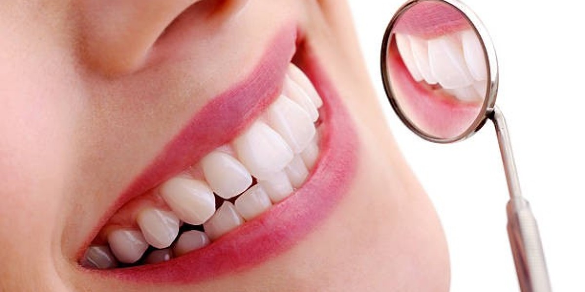 Arch Dental Woodbury Offers Teeth Whitening Services in Nassau County New York