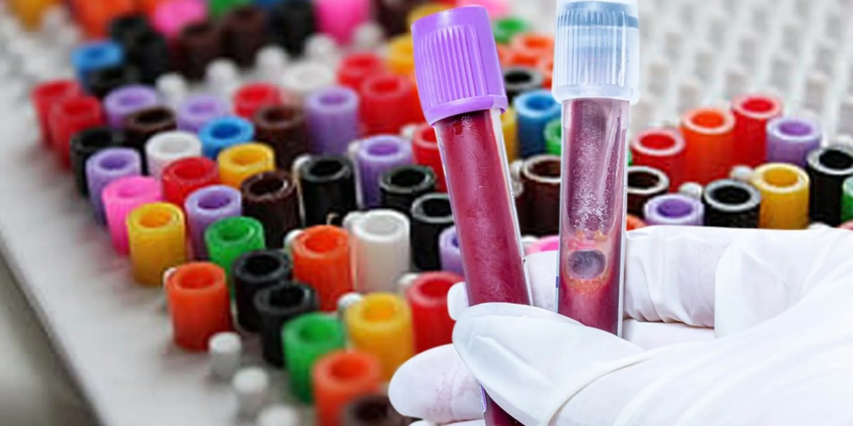 Blood Collection Tubes Market Grows Amid Rising Healthcare Demand and Diagnostics