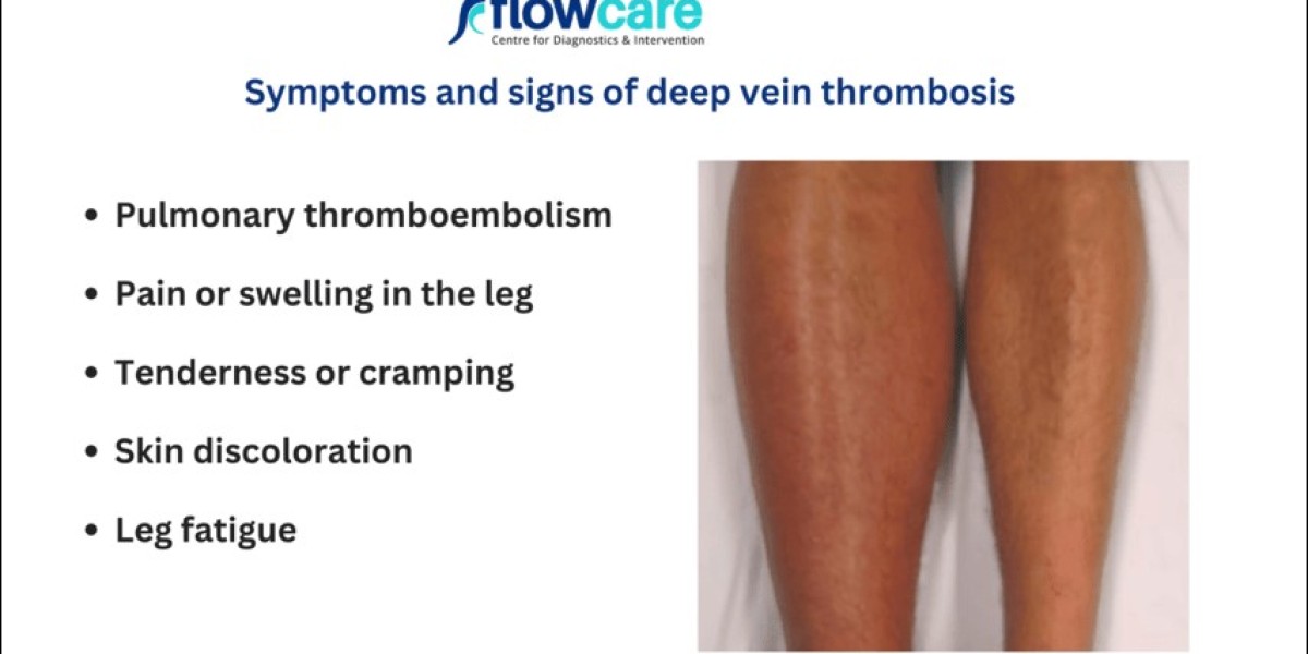 Understanding the Signs of DVT in Leg: What You Need to Know