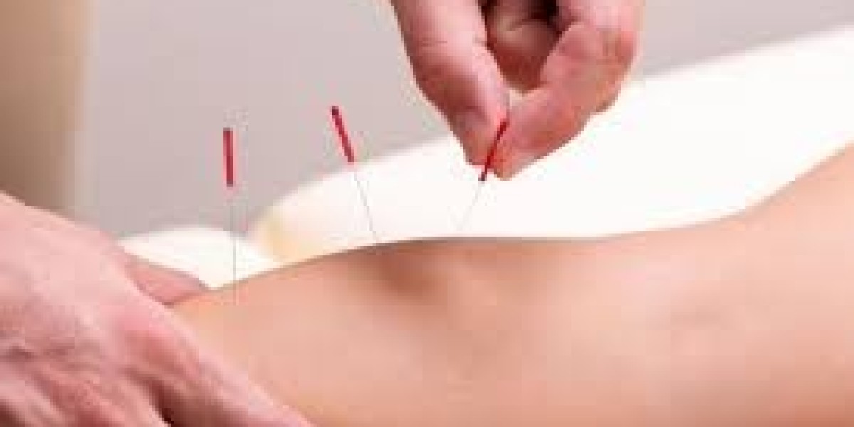 Acupuncture for Athletes: Tailored Protocols for Endurance Athletes in 2024