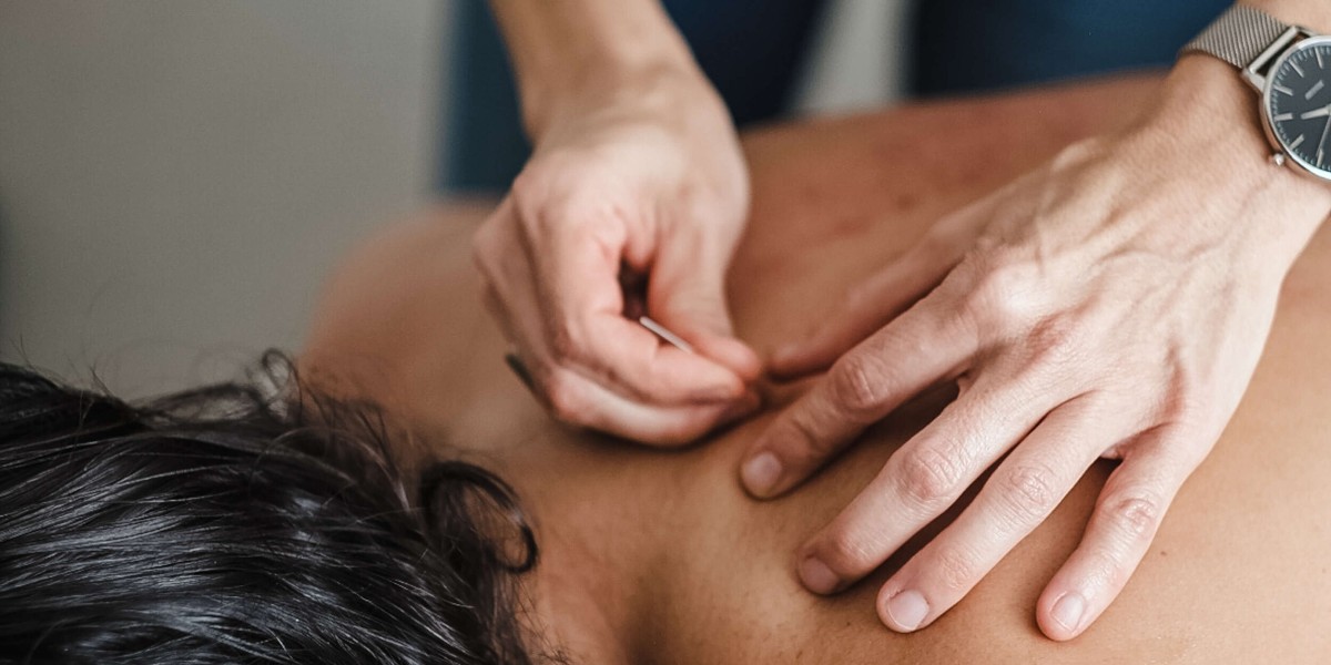 Acupuncture in St. Petersburg – A Time-Tested Approach to Wellness