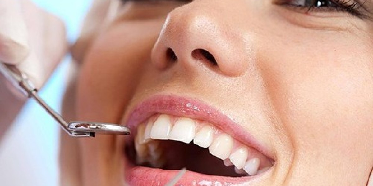 Dental Implants in Tampa: A Comprehensive Guide to Restoring Your Smile