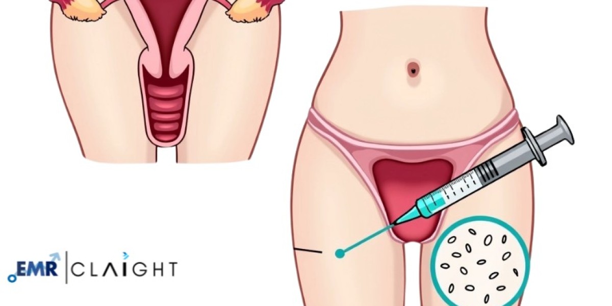 Artificial Insemination Market Size, Share, and Industry Forecast 2034