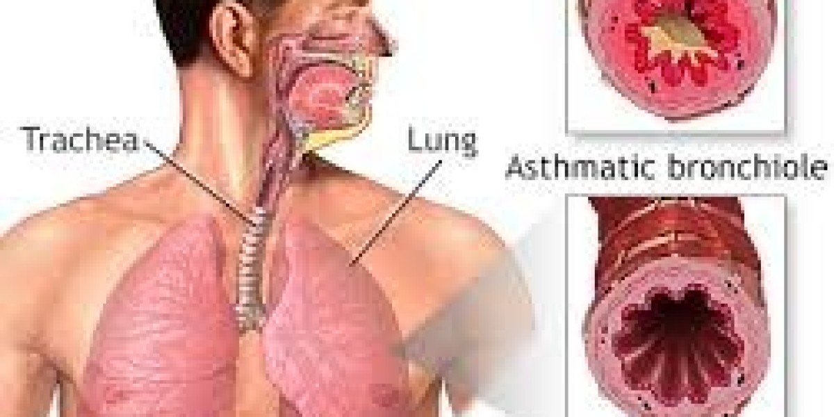 Asthma and Allergies in Children: Early Detection and Treatment Strategies