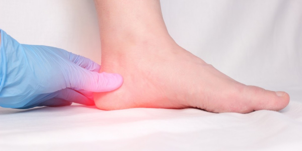 Say Goodbye to Heel Pain: How a Plantar Fasciitis Foot Strap Can Help