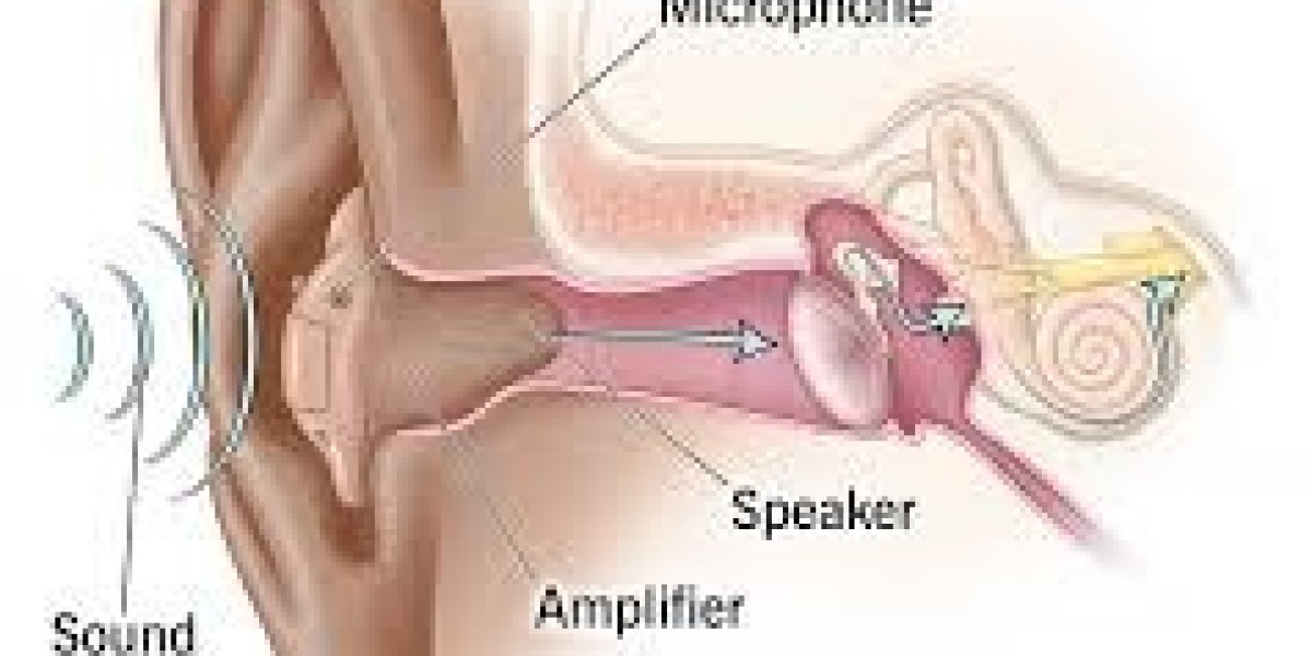 Hearing Aid Service and Repair for Better Sound