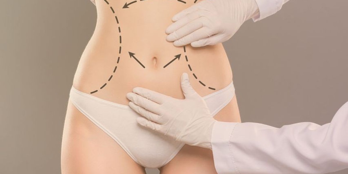 Tummy Tuck Surgery in Dubai - Achieve a Sculpted Abdomen with Expert Care